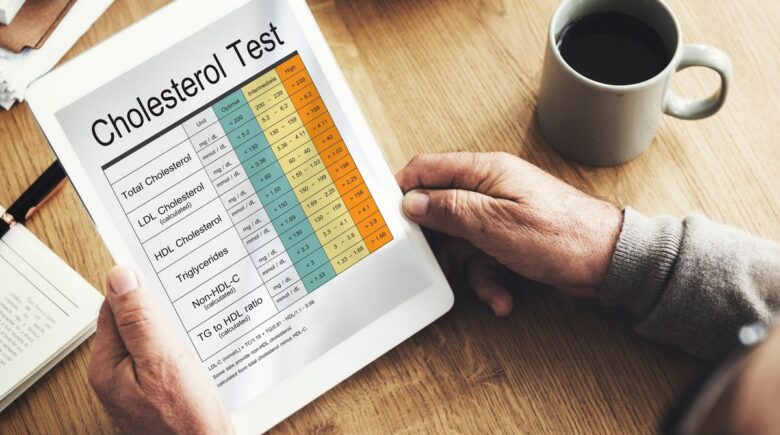 New York resident with high cholesterol applying for no-exam life insurance